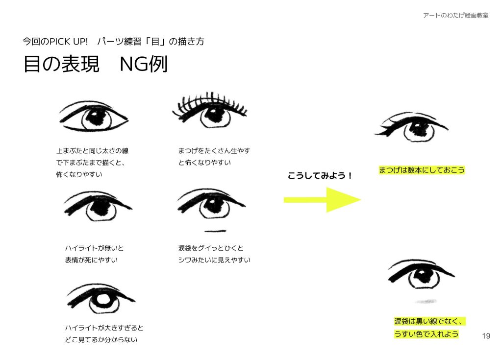 目の表現　NG例。上まぶたと同じ太さの線で下まぶたまで描くと、怖くなりやすい。まつげをたくさん生やすと怖くなりやすい。ハイライトが無いと表情が死にやすい。涙袋をグイっとひくとシワみたいに見えやすい。ハイライトが大きすぎるとどこ見てるか分からない。まつげは数本にしておこう。涙袋は黒い線でなく、うすい色で入れよう。
